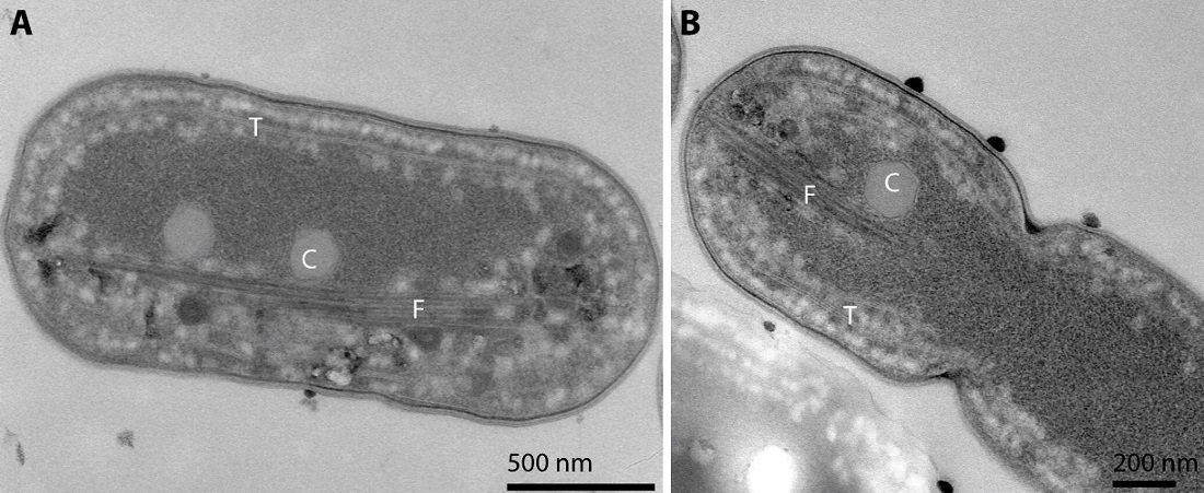 Cyanobacteria with protein fibres seen through a microscope